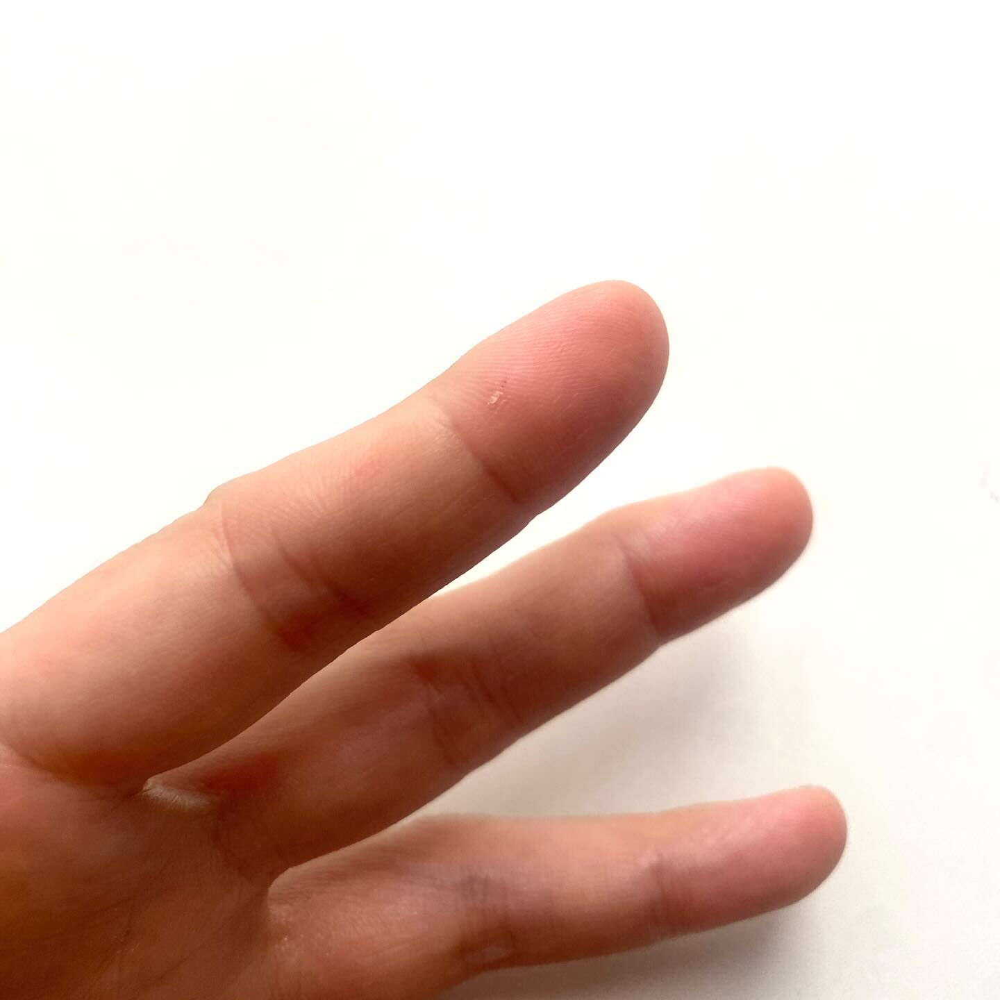魚を調理していたら、手を滑らせて骨が刺さりまして🐟