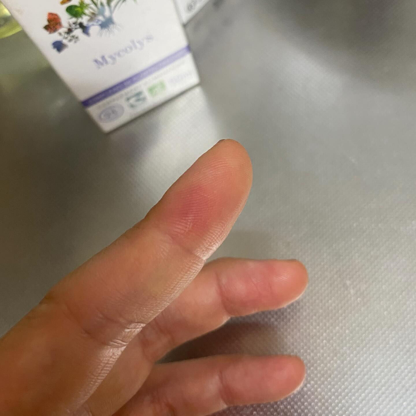 魚を調理していたら、手を滑らせて骨が刺さりまして🐟