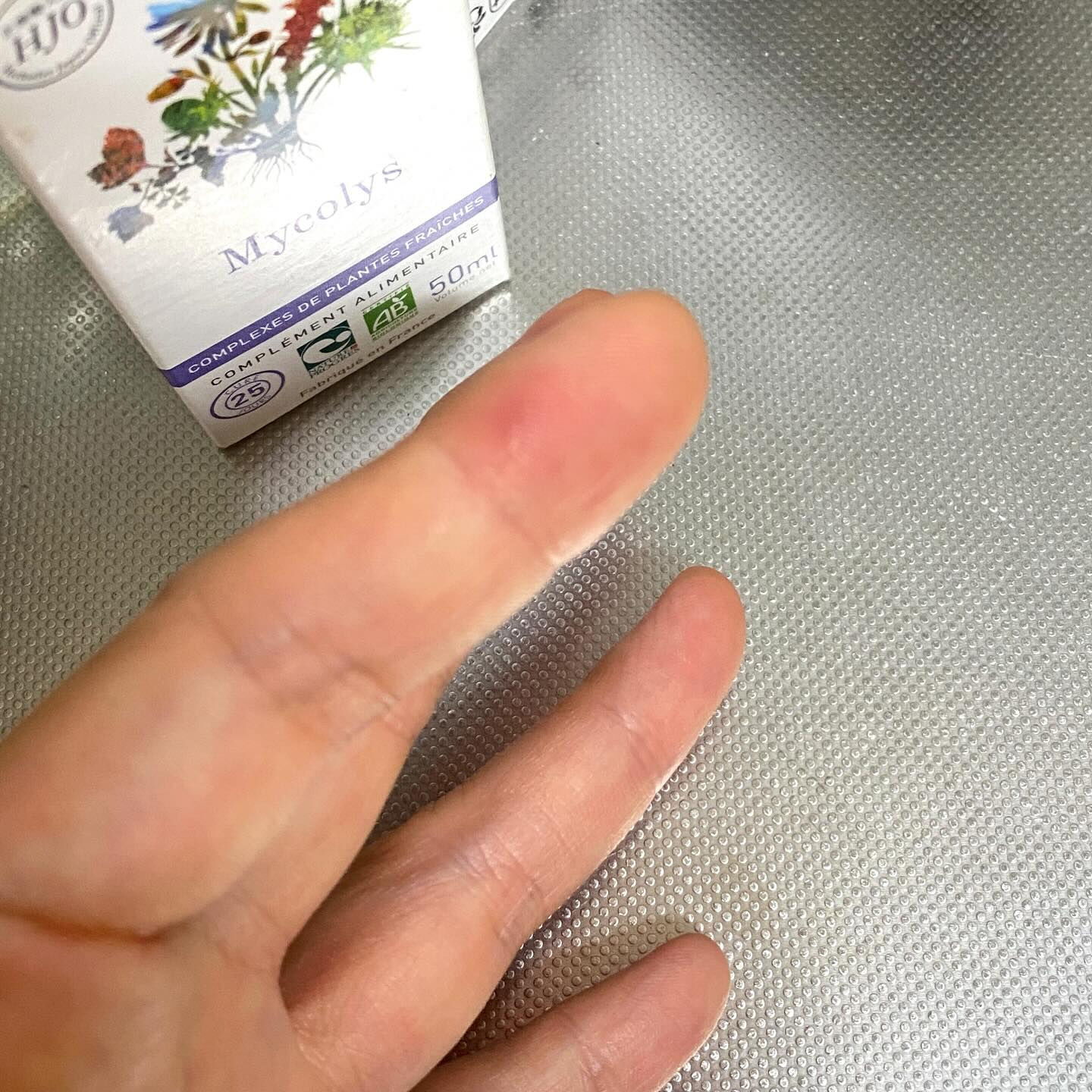 魚を調理していたら、手を滑らせて骨が刺さりまして🐟