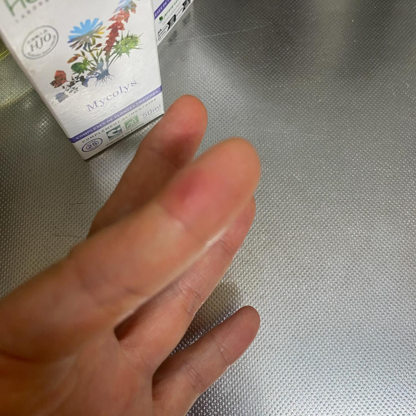 魚を調理していたら、手を滑らせて骨が刺さりまして🐟