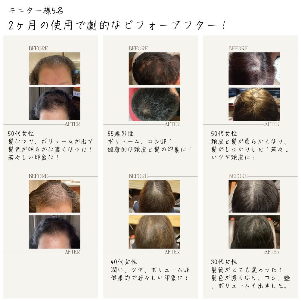 「美容室で数年ぶりに『髪、すきますか？』と聞かれてびっくり😳